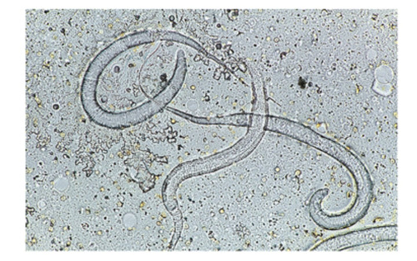 <p>These larvae from a skin nematode of dogs are recovered by finding an adult in an ulcerative lesion and soaking the female in warm water to make her expel her larvae. The larvae are identified as</p>