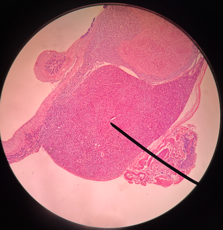 • The anterior lobe of the hypophysis.

• Composed of glandular tissue.

• Regulated by the hypothalamus.