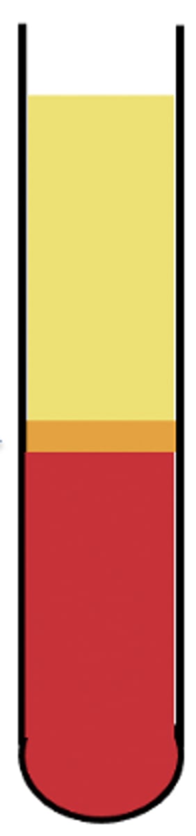 <p>Which color are the platelets in?</p>