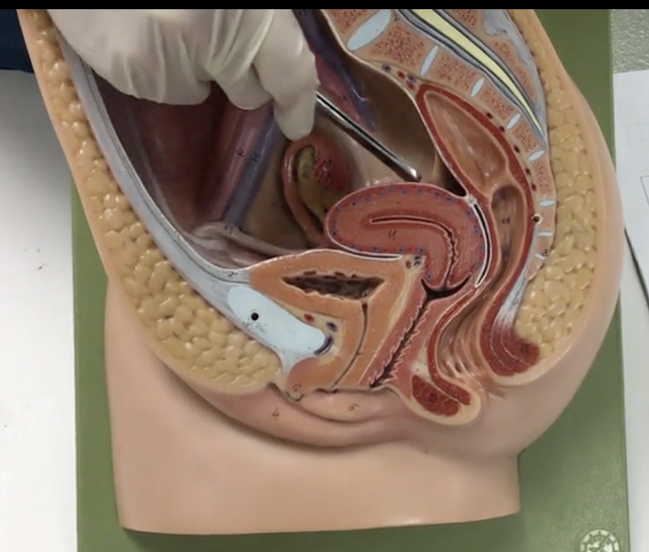 <p>Description: Wide, dome shaped portion of the uterus superior to openings of the uterine tubes</p><p>Relationship: N/A</p>