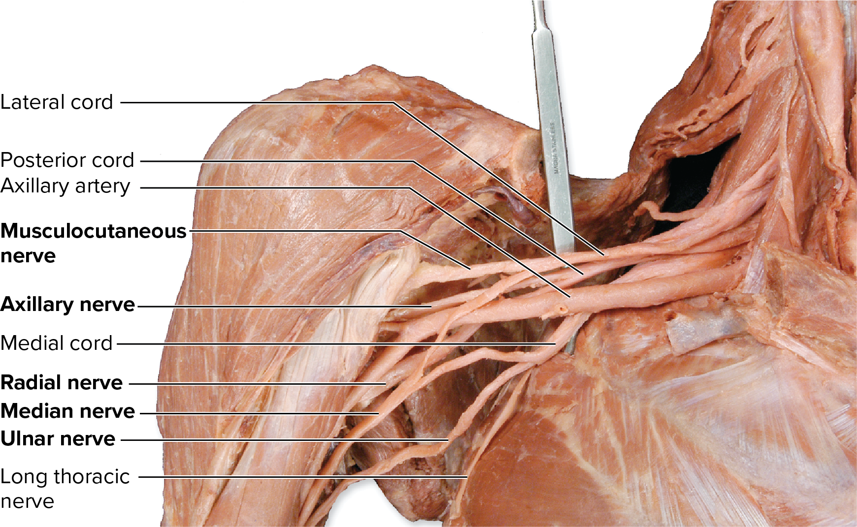 <p>Structure of the Brachial Plexus (Medial to Lateral)</p>