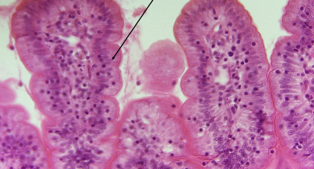 <ol><li><p><strong>Name this tissue type</strong></p></li><li><p><strong>Explain it’s function.</strong></p></li></ol><p></p>