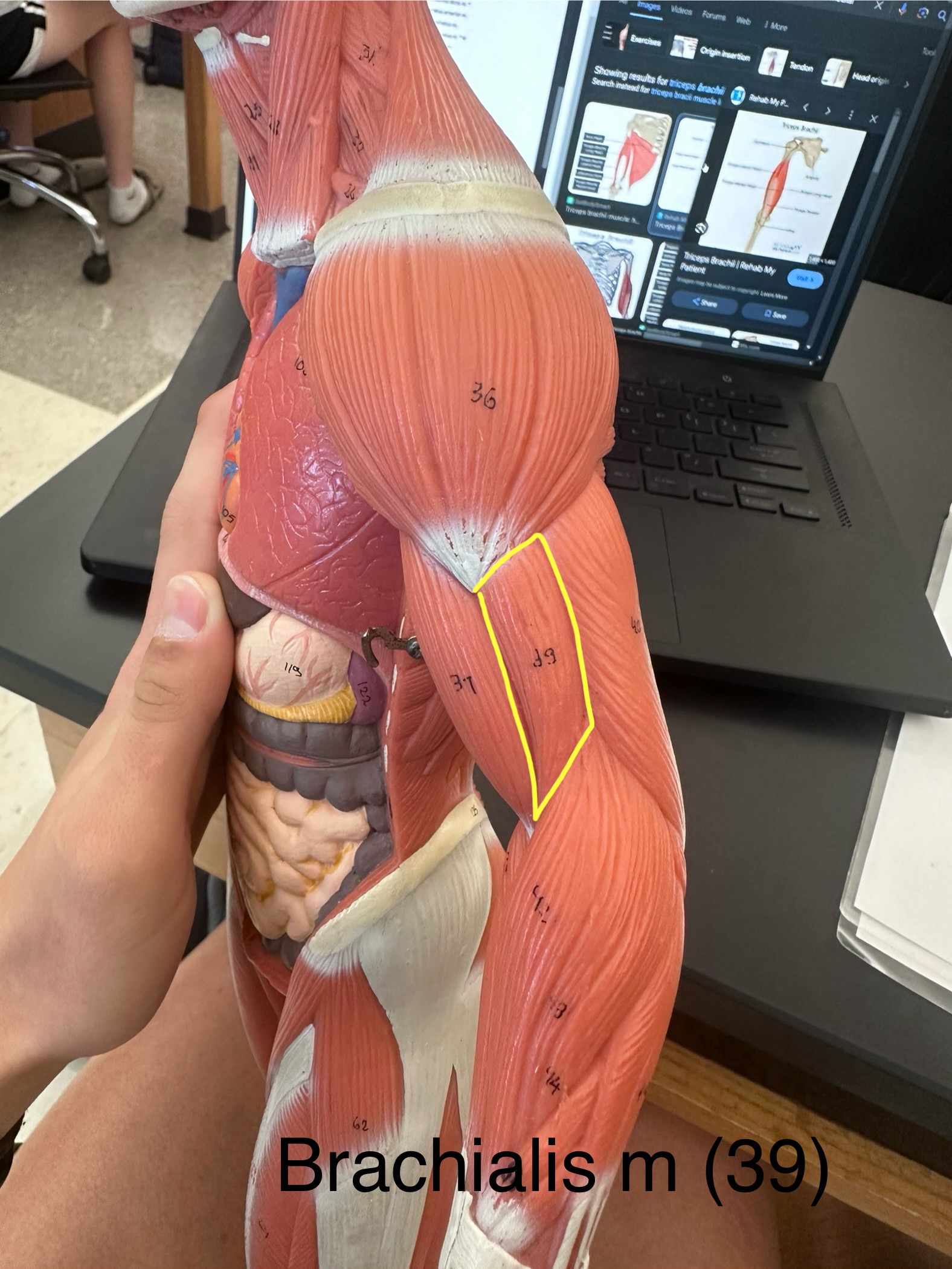 <p>Brachialis muscle. This muscle is the major forearm flexor. It lifts the ulna as the biceps lifts the radius.</p><ul><li><p>The origin is the anterior surface of the distal humerus</p></li><li><p>The insertion is the coronoid process of the ulna</p></li></ul>