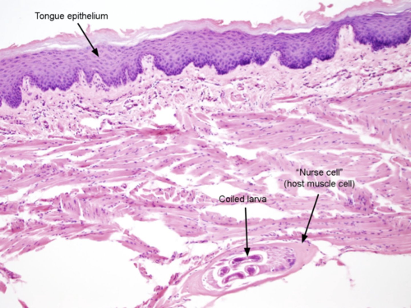 <p>Found in the tongue muscle of a boar. What parasite is this?</p>