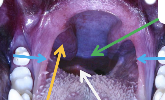 <p>what is the yellow arrow pointing to?</p>