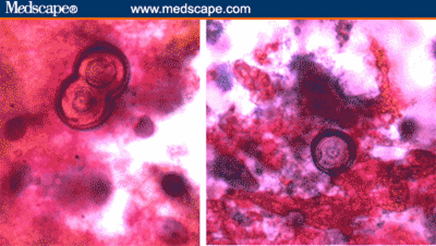 <p>iD this fungi in lungs</p>