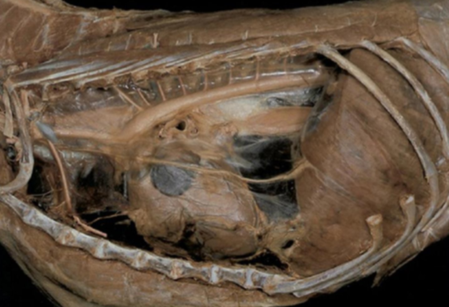 <p>Thoracic part of the esophagus:</p><p>points most likely to cause obstruction</p>