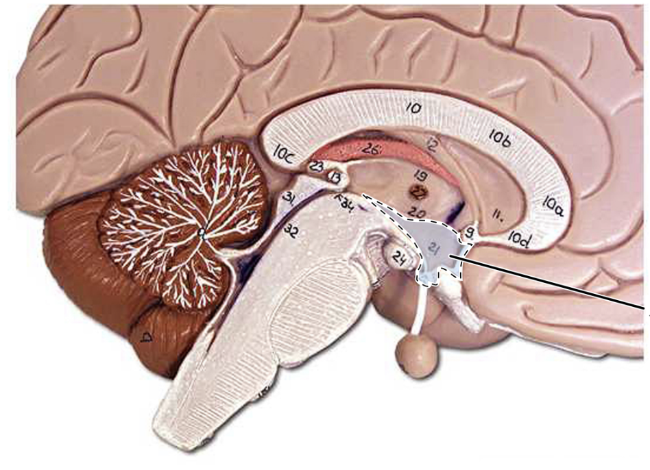 term image