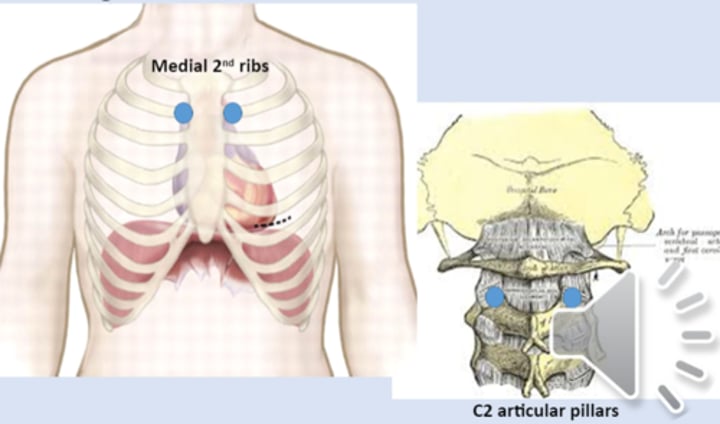 <p>anterior point: medial 2nd ribs<br>posterior point: C2 articular pillars</p>