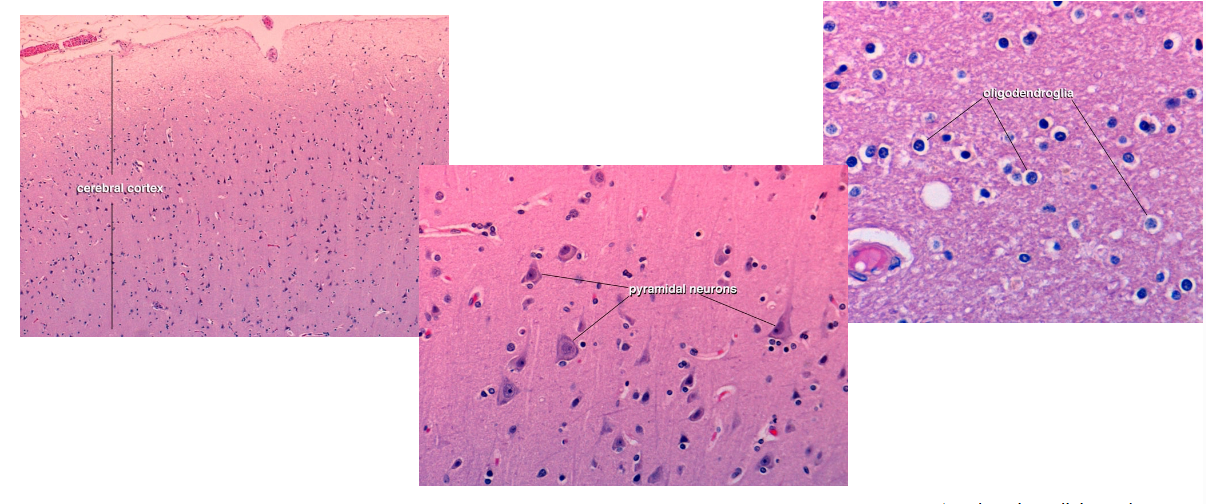 <p>Mostly the nuclei of glial cells are seen in routine histologic preparations of the CNS </p>
