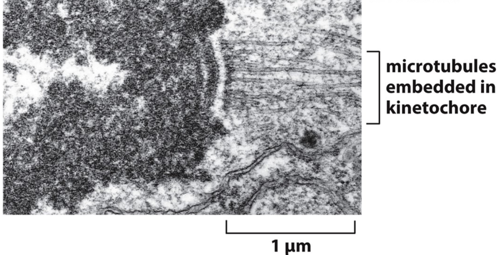 What is shown in this electron microscope image?