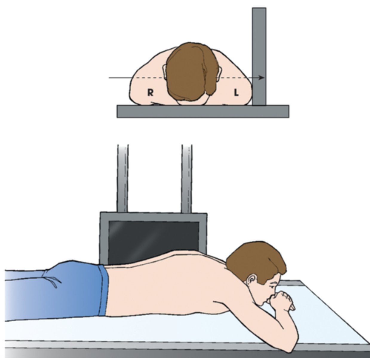 <p>patient is prone &amp; horizontal beam is used</p><p>Left X radiographic position of abdomen results in left lateral projection. Note horizontal orientation of central ray.</p>
