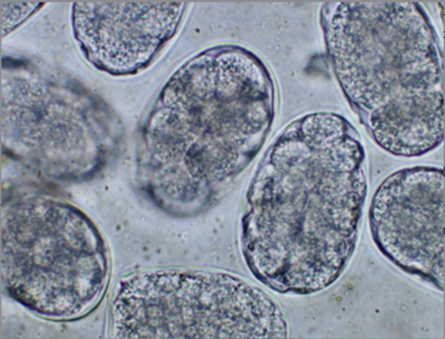 <p>These eggs were found on a fecal flotation of a 9 week old puppy. They measure 60x40um. How was puppy infected?</p>