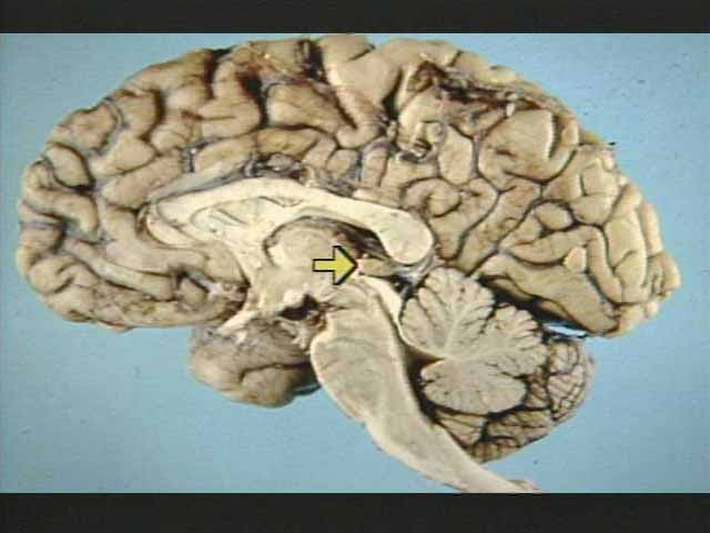 <p>What is this arrow pointing to? </p>