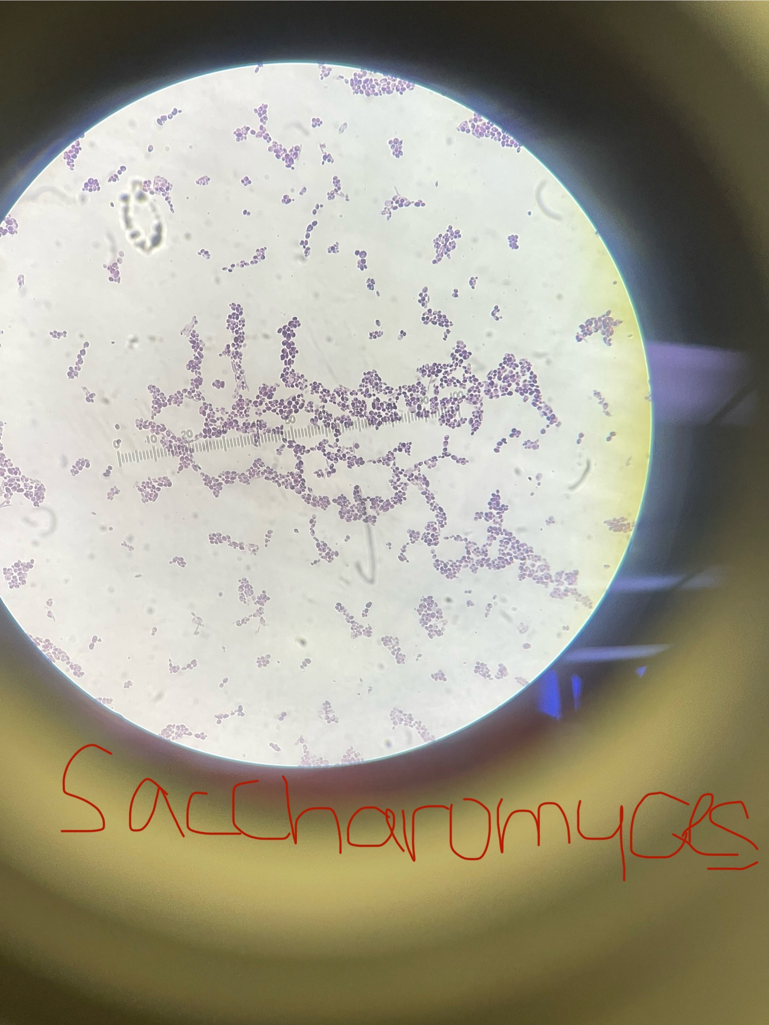 <p>Domain: Eukarya</p><p>Kingdom: Fungi</p><p>Phylum: Ascomycota</p><p>Genus: Saccharomyces</p><p>Species: cerevisiae</p><p>Decomposer- not a pathogen</p><p>No sexual form</p><p>Brewing and bread yeast</p><p>Asexual - budding</p><p></p>