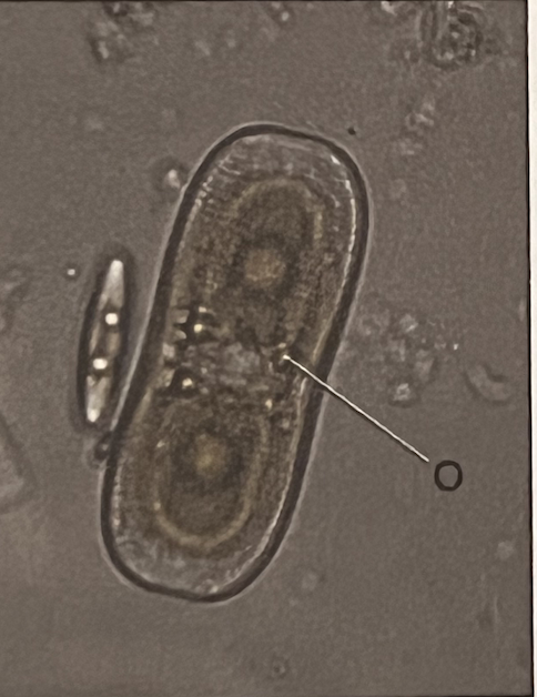 Diatom 