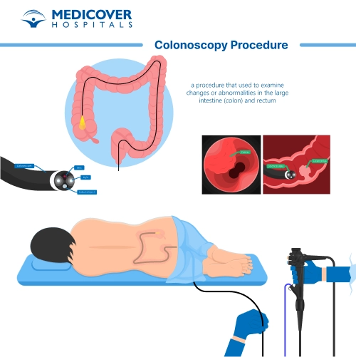 <p><span style="color: rgb(38, 160, 23);"><strong>Colonoscopy @ age 45!</strong></span></p><ul><li><p>then q10 years</p></li></ul><p></p><p><span style="color: rgb(10, 158, 146);"><strong>Fecal Occult Test </strong></span>annually!</p>