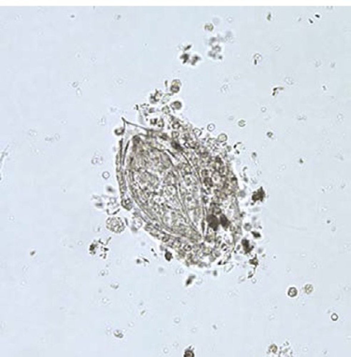 <p>b. Schistosoma haematobium</p>