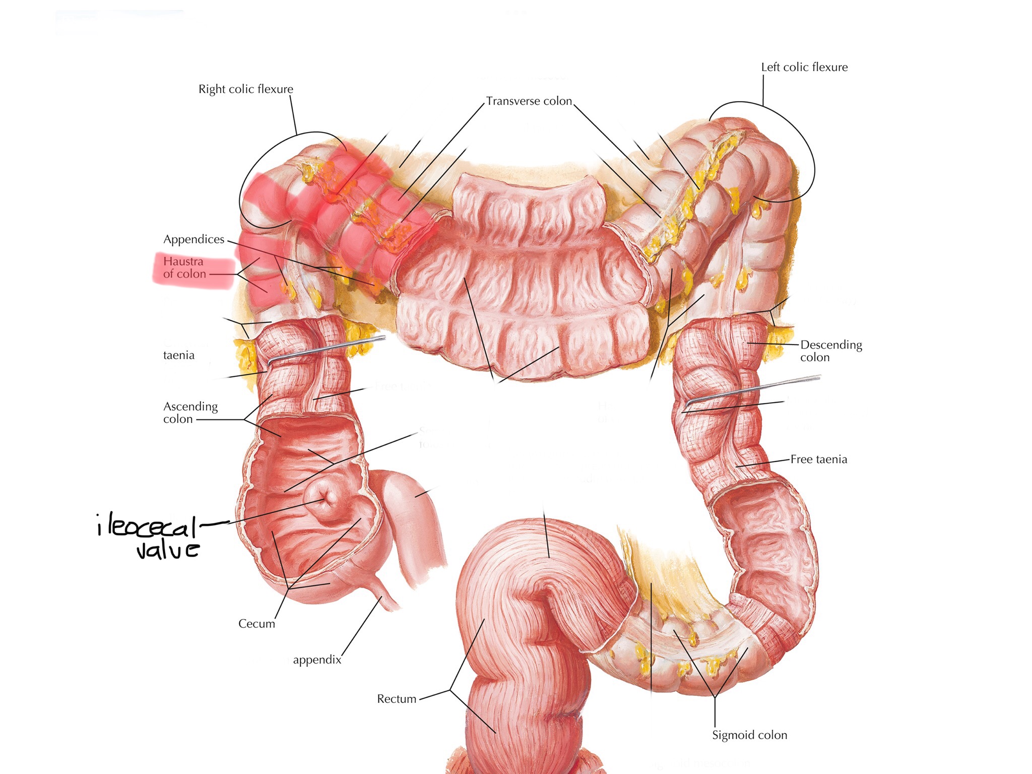 knowt flashcard image