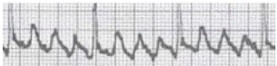 <p>What rhythm is this?</p>