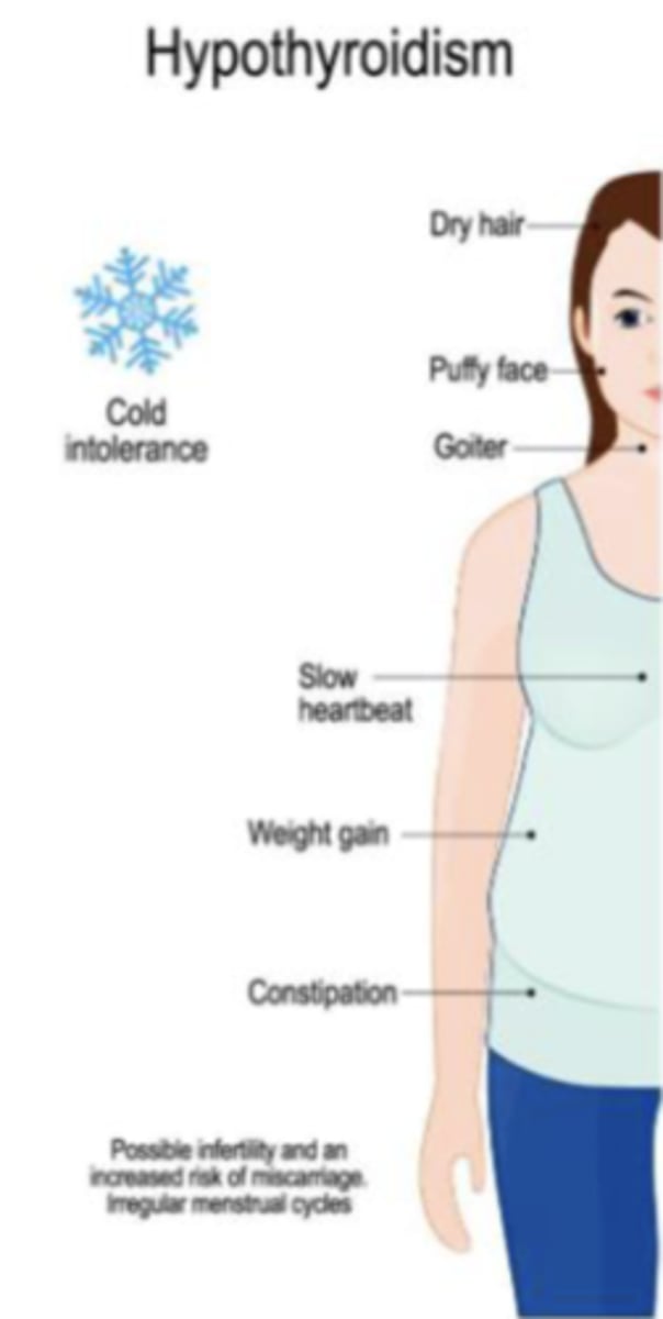 <p>- dry hair</p><p>- puffy face</p><p>- goiter</p><p>- slow heat beat</p><p>- weight gain</p><p>- constipation</p><p>- cold intolerance</p><p>- possible infertility and an increased risk of miscarriage, irregular menstrual cycles</p>