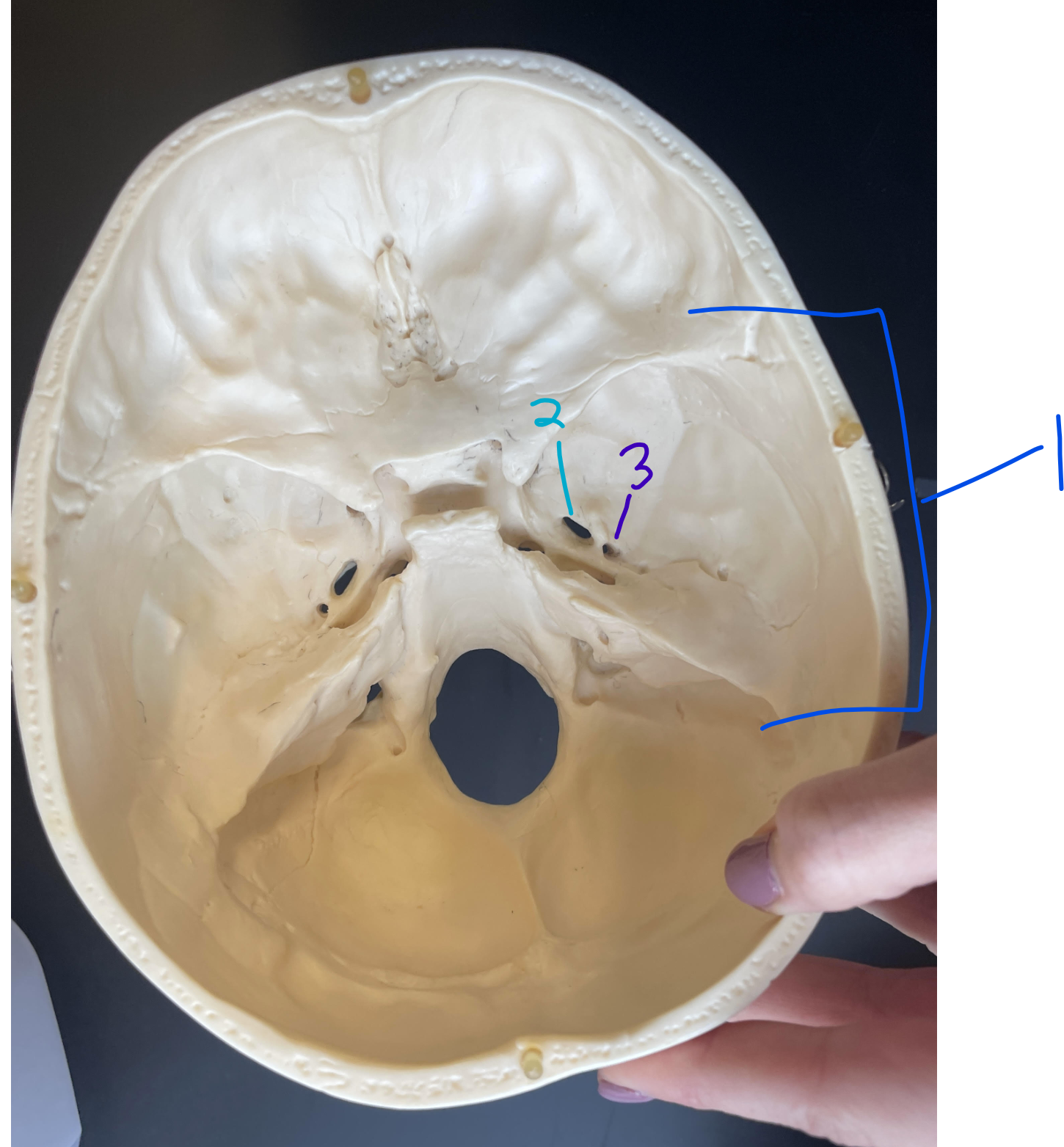 <p>what bone is #1?</p>