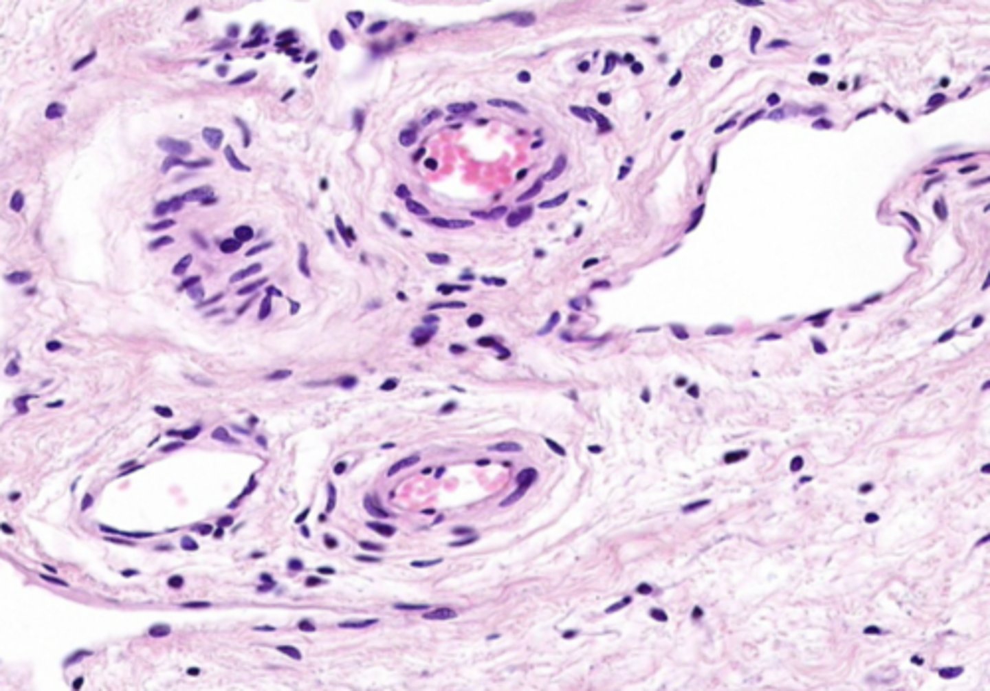 <p>blood supplying oxygen and nutrients to eye</p>