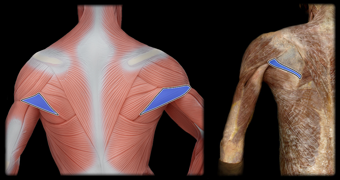 <p>insertion of teres minor</p>