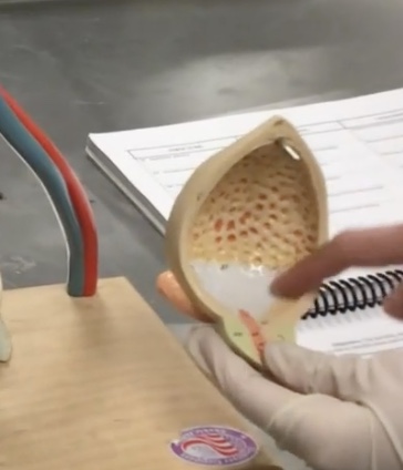 <p>Description: Smooth, triangular region on the internal surface of the urinary bladder</p><p>Relationship: Ureteral openings form the base and the urethral opening forms the apex</p>