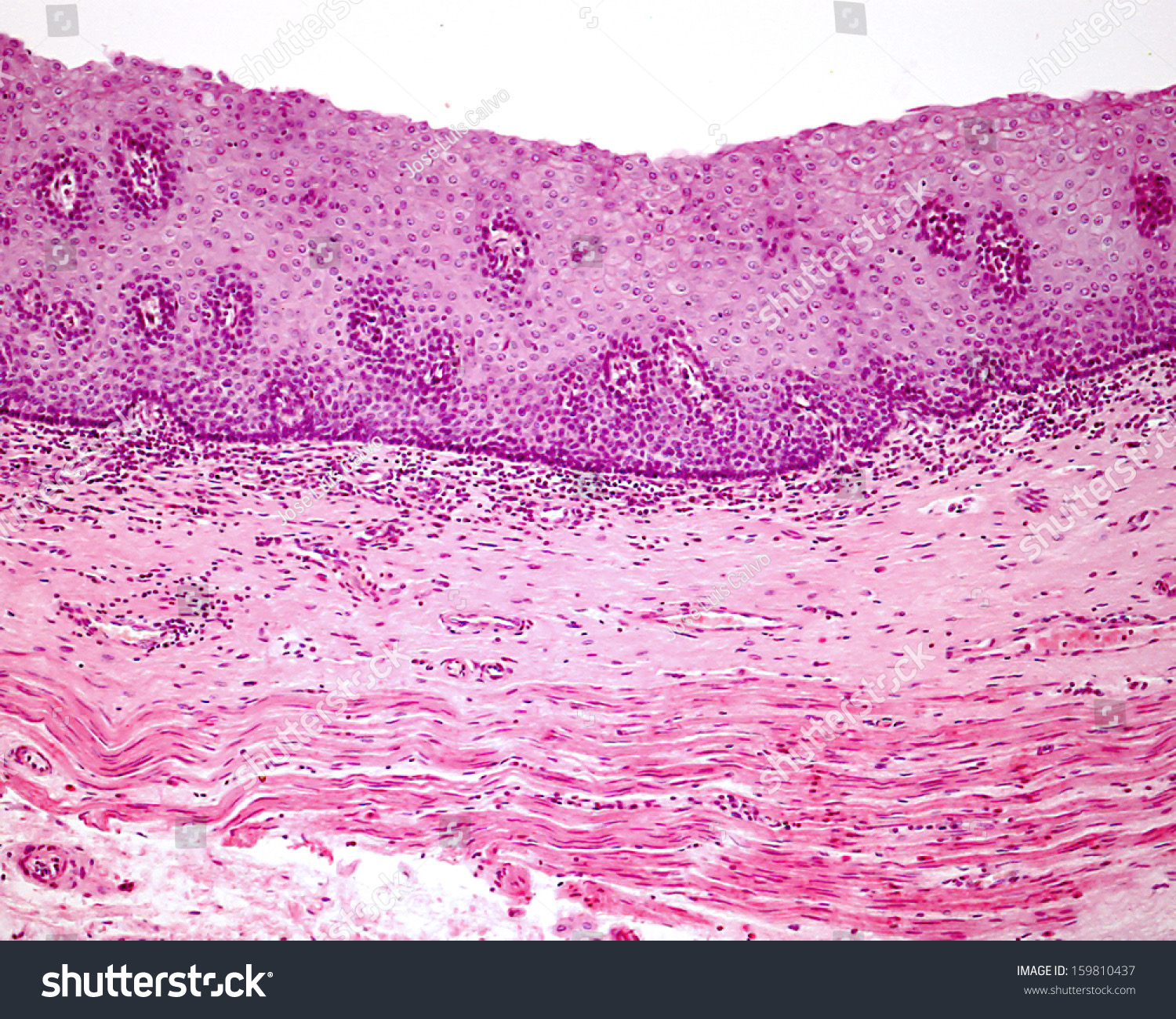 <p>Stratified Squamous Epithelium (Nonkeratinized)</p>