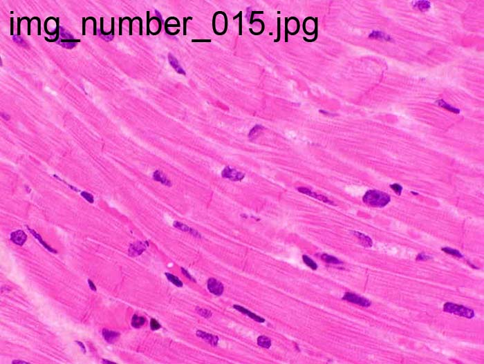 <p>Cardiac muscle </p>