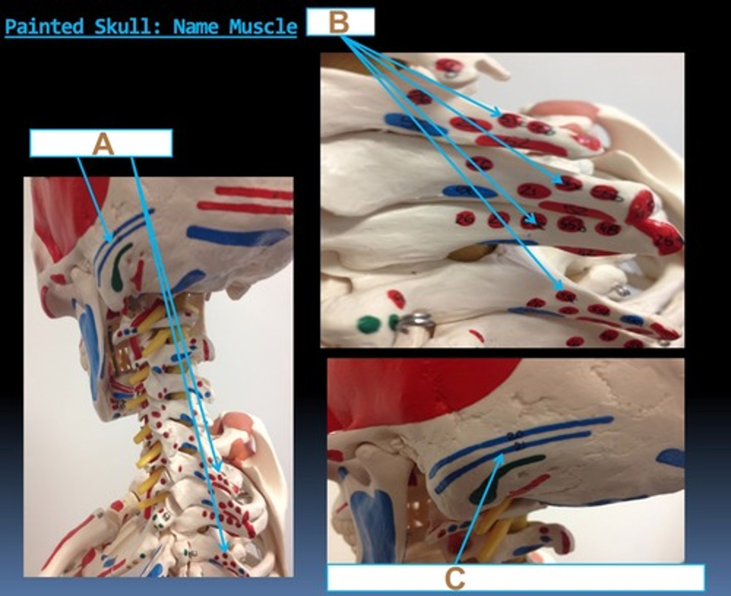 <p>55c/21C insertion</p>