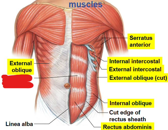 <p>What part of the muscle is this?</p>