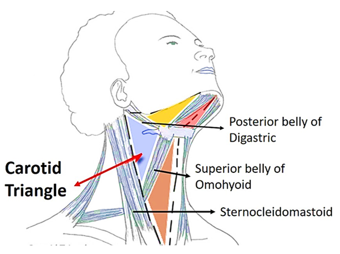<p>List the boundaries of carotid triangle:</p><p>A. <strong>venter posterior of m. digastricus</strong></p><p>B. <strong>m. sternocleidomastoideus</strong></p><p>C. <strong>m. omohyoideus - venter superior</strong></p>