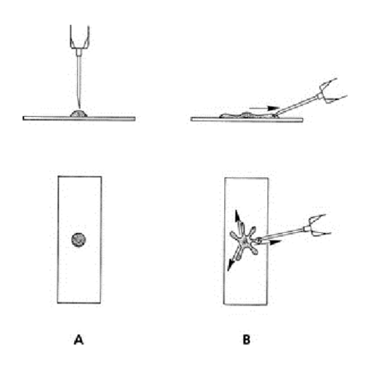 <p>What slide prep method is this?</p>