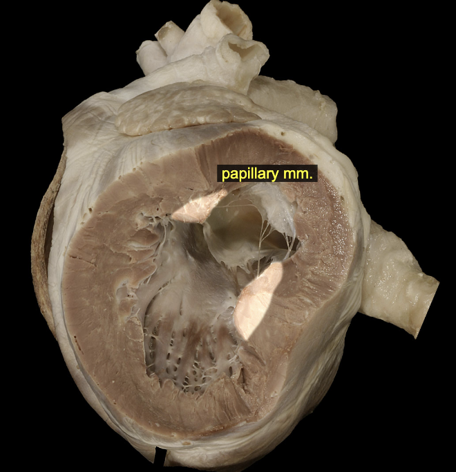 <p>The papillary muscles are raised, blunt projections of the interior ventricular wall. The right ventricle of the dog typically possesses three main papillary muscles, although variations (fusions, splitting, and duplications) are common. The left ventricle more consistently possesses two papillary muscles. The collagenous <mark data-color="green">chordae tendineae </mark>that tether the valve leaflets of the atrioventricular valves are anchored in the papillary muscles.</p>