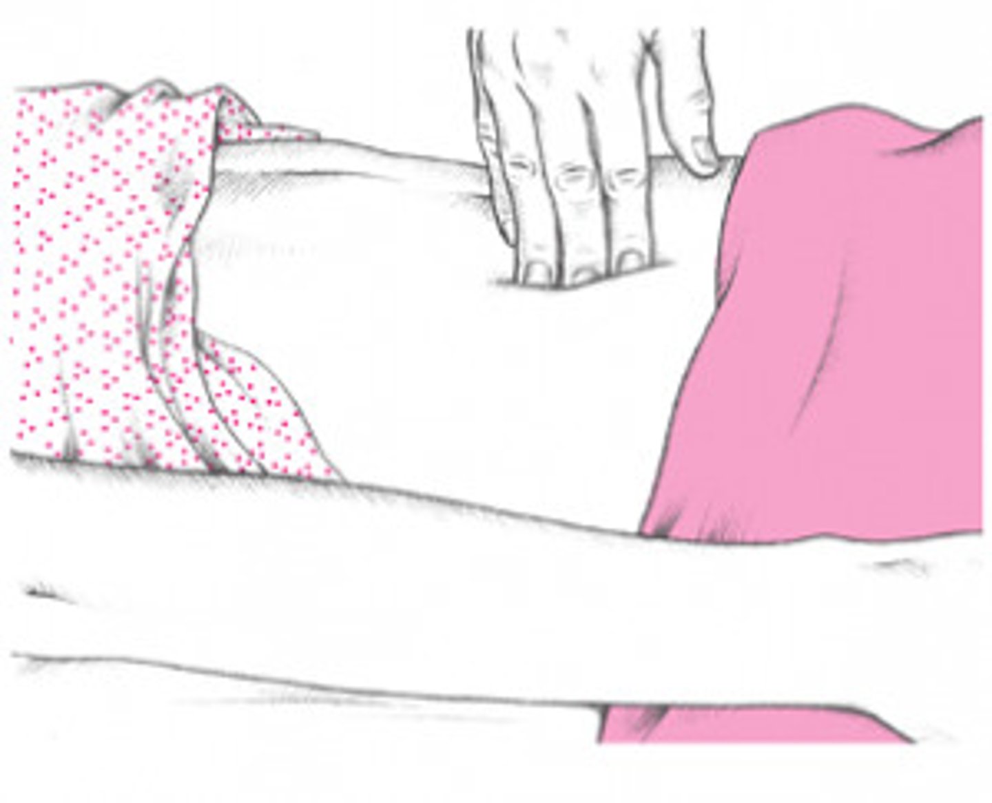 <p>pain when releasing the hand from abdominal palpation</p>