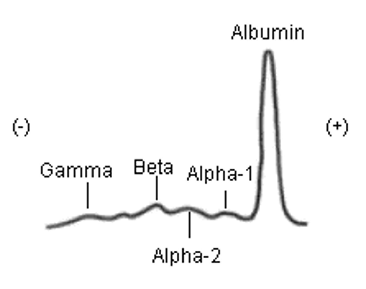 <p>In serum protein electrophoresis all of the following proteins reside in the band closest to the anodal end EXCEPT:</p><p>Please select the single best answer</p><p>Retinol-binding protein (RBP)</p><p>Transthyretin</p><p>Albumin</p><p>Haptoglobin</p>