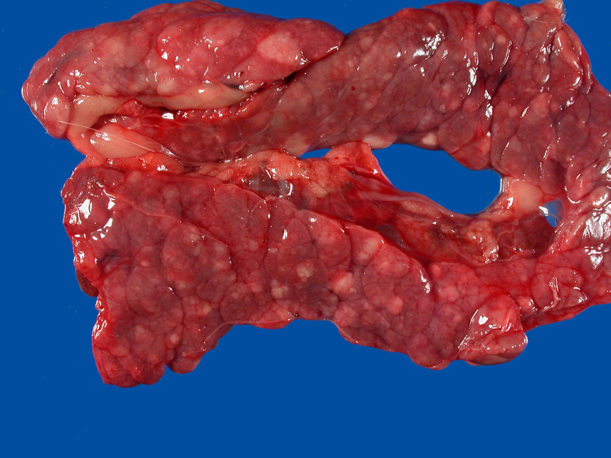 <p>What organ is this? Give a morphological description, morphological diagnosis,</p>