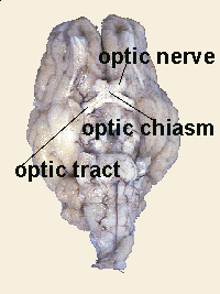 <p>The X-shaped structure formed at the point below the brain where the two <span>optic</span> <span>nerves</span> cross over each other</p>