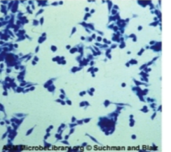 <p>Which type of virus does CPE detect, cell enlargement rounding and distinctive grape-like clusters. </p>