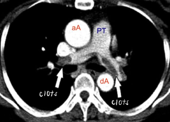 <p>diagnosis</p>