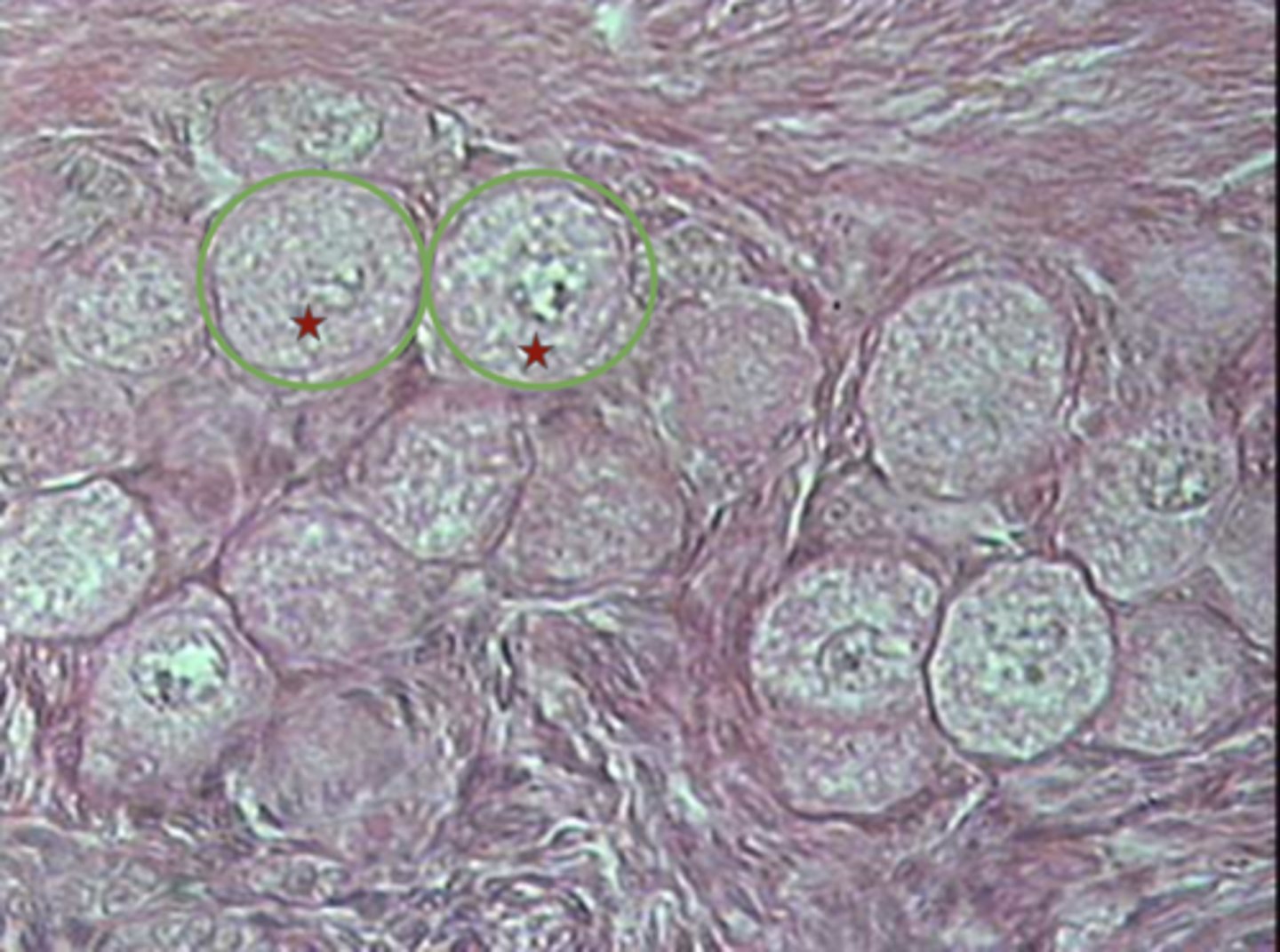 <p>What is the green circle?</p>