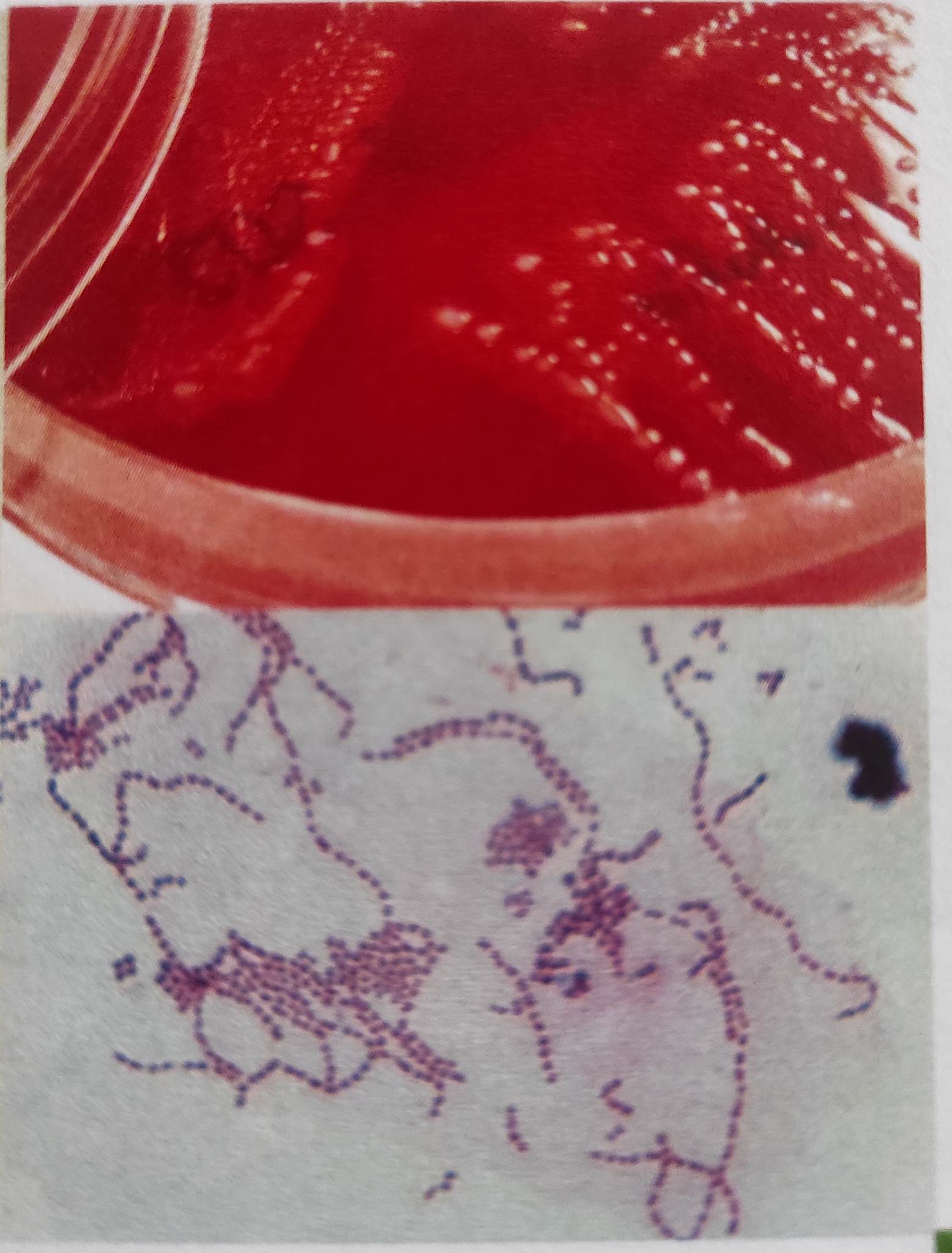 * Catalase (-)
* Gram (+) cocci in pairs and in chains
* more elongated 
* **can ferment glucose** but no gas