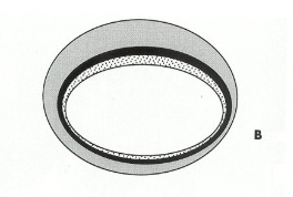 <p>What does this image show</p>