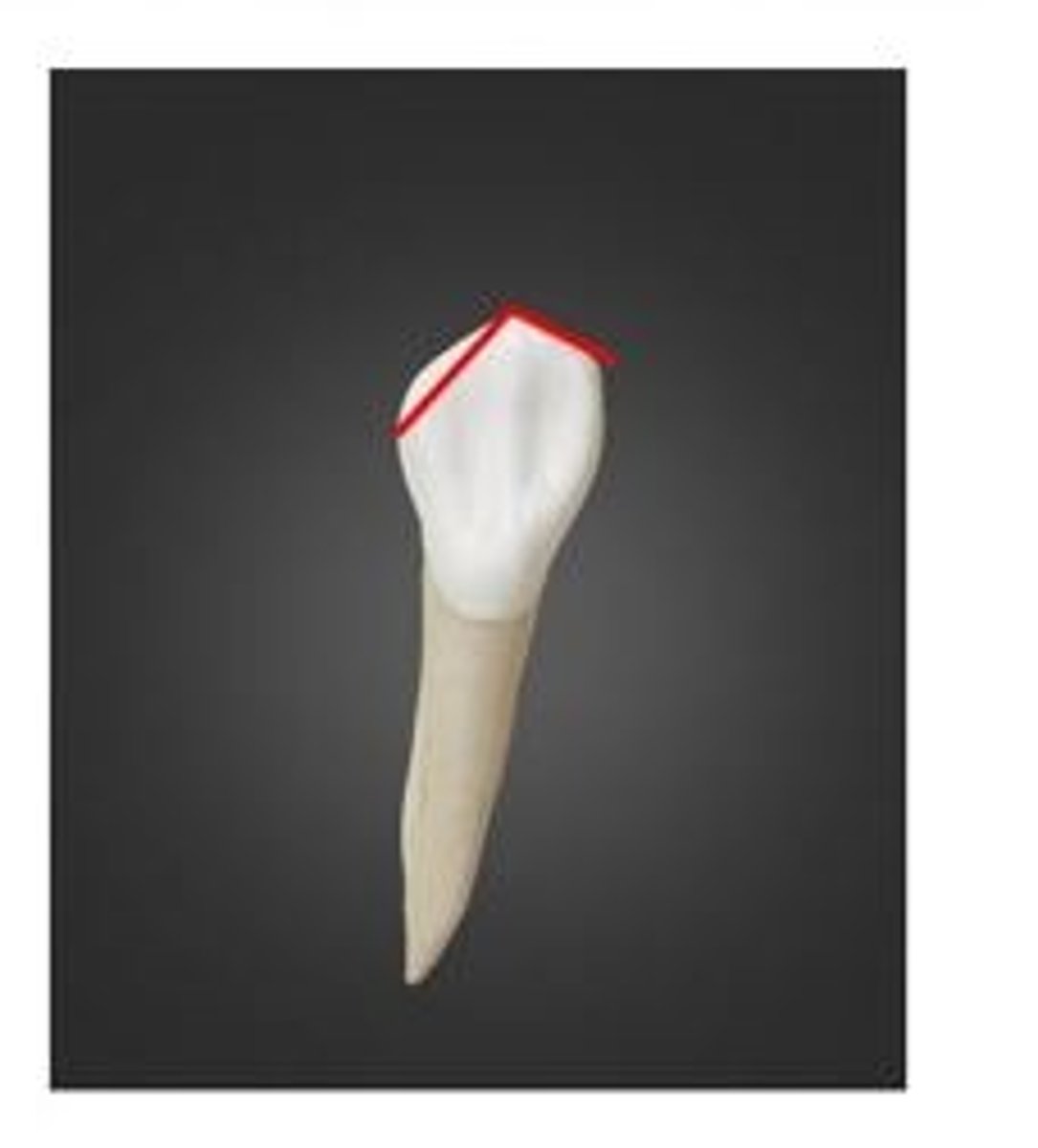 <p>Using the Universal Numbering System, what tooth number is this? (This is the lingual view)</p>