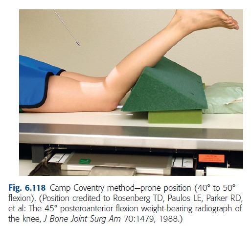 <p>what stupid exam is this? </p><p>what does it look at? (inter____ ____)</p><p>what’s the leg angle? </p><p>what is the CR perp to?</p>