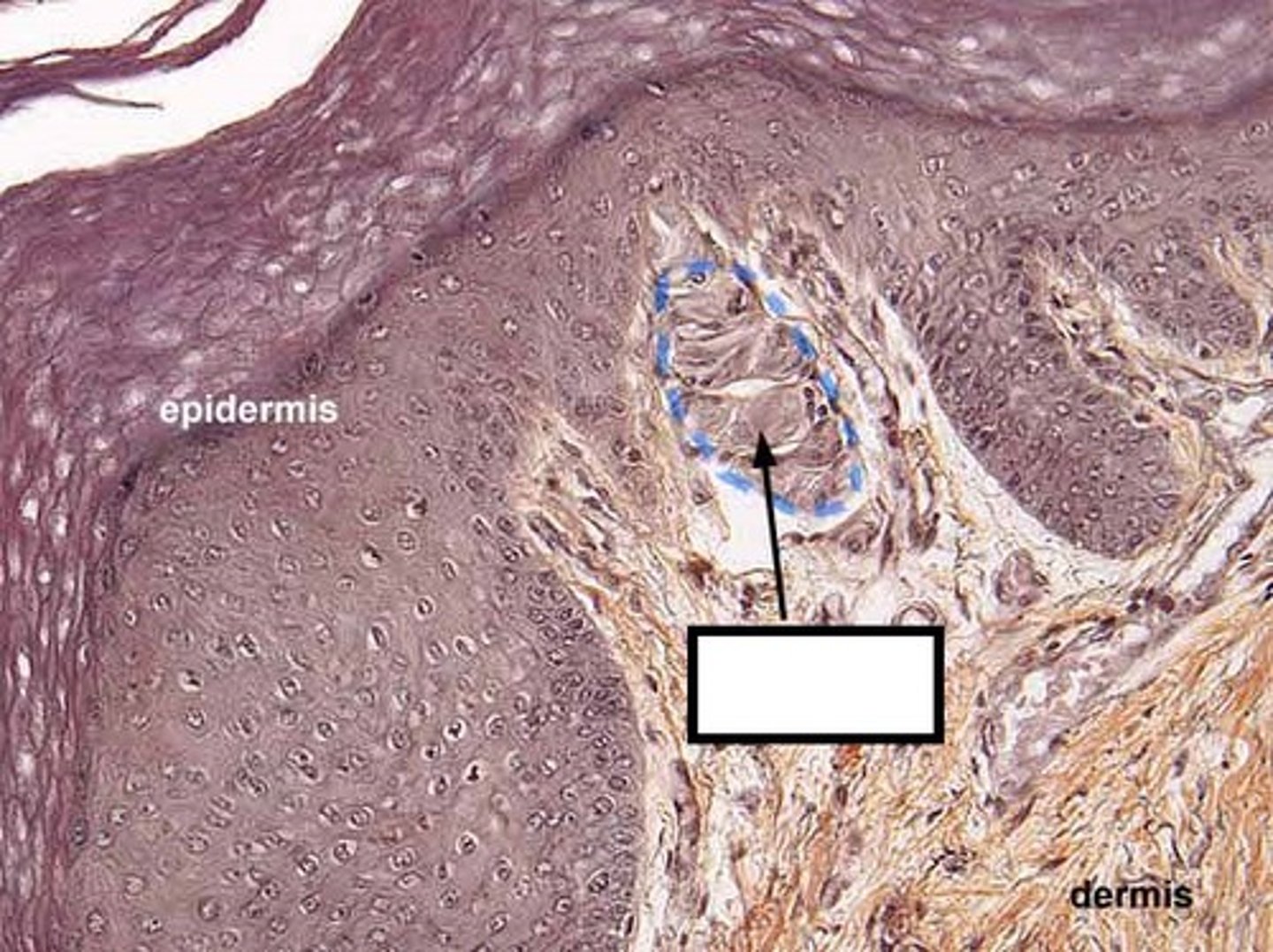 <p>- sensory receptors that respond to light touch</p><p>- found in dermal papillae in dermis</p><p>- in skin of fingertips, lips, face, external genitalia</p>