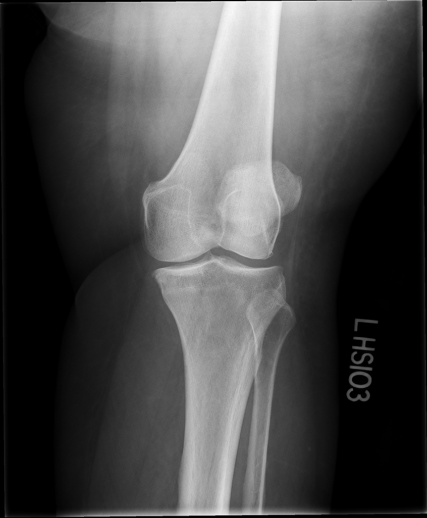 <p>what is the critique of this lateral oblique?</p>