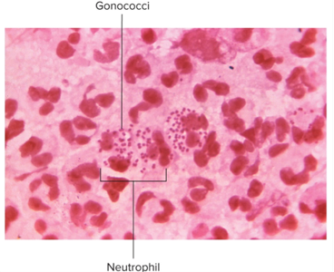 <p>N. gonorrhoeae and N. meningitidis;</p><p>gram negative, bean shaped, diplococci; strict parasites that do not survive long outside of the host; aerobic or microaerophilic</p>